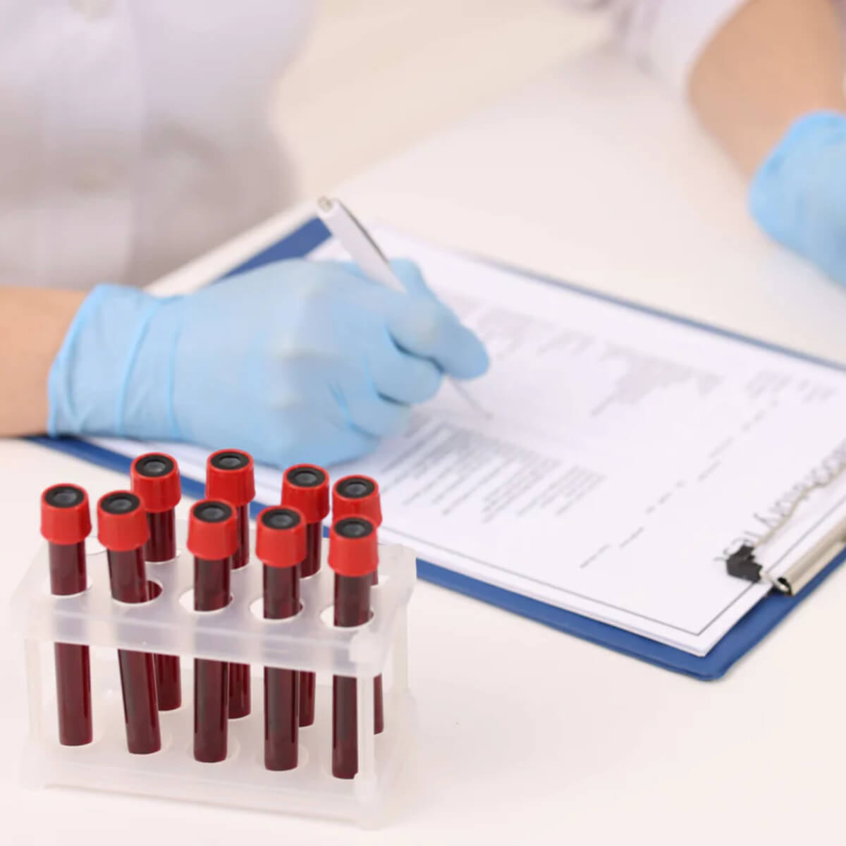 Person with blood sample tubes and a clipboard